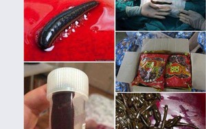 Thực hư ca phẫu thuật toàn đỉa tại BV Bạch Mai
