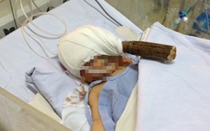 Kẻ lạ mặt lẻn vào phòng bệnh đâm xuyên đầu bé trai 11 ngày tuổi