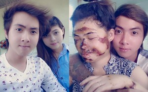 Tình đẹp của anh chàng điển trai và bạn gái "biến dạng"