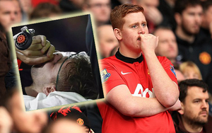 Con số khiến Man United run rẩy vì Luke Shaw
