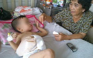 Thương tâm: Bé trai 3 tuổi bị người tình của mẹ đạp vỡ đại tràng