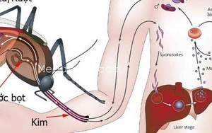 Đừng ăn trứng, uống nước ngọt khi đang mắc bệnh này kẻo nguy hiểm