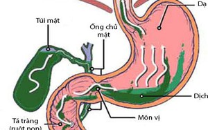 Khi có bệnh này phải chữa ngay kẻo ung thư "gõ cửa"