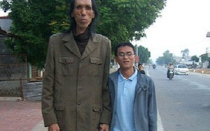 Hình ảnh những người có chiều cao ngất ngưởng ở Việt Nam