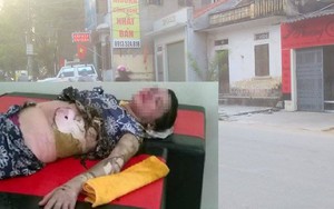 Giây phút tưới xăng đốt vợ của gã chồng cuồng ghen