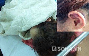 Thiếu nữ uất ức kể bị bạn trai đánh, bắt "quan hệ" ở nhà nghỉ