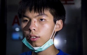 Joshua Wong bị đánh sau khi đi xem phim cùng bạn gái