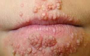 Bi hài bố vợ nhận "quà" đắng sùi mào gà từ con rể muốn đào mỏ