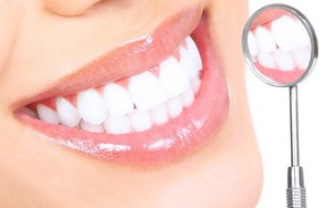 Ba cách loại bỏ cao răng tại nhà