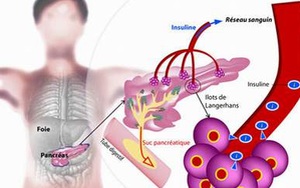 Nếu cứ ăn vô tội vạ thứ này, đường ra nghĩa địa rất "ngọt ngào"!