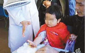 Hy hữu: Bé 3 tuổi mất ngón tay vì một vết đứt