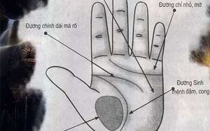 Đoán sức khỏe, vận may thông qua các dấu hiệu ở bàn tay