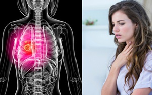 Dấu hiệu ung thư phổi ở nam và nữ khác nhau: Chị em cảnh giác với những biểu hiện "mập mờ"