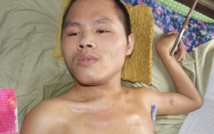Lạ lùng chàng trai viết tâm thư tình nguyện… hiến đầu