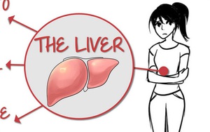 Đây là những điều bạn cần làm hàng ngày để giải độc cho gan