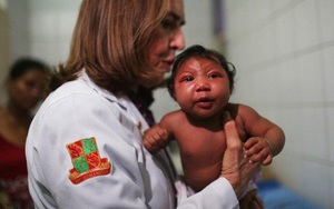 Virus Zika lây lan đến 3 nước láng giềng của Việt Nam