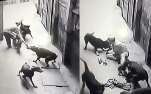 Đau thương: Người đàn ông dắt chó bị cắn xé tơi tả
