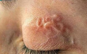Cảnh báo 3 món ăn nhiễm ký sinh trùng