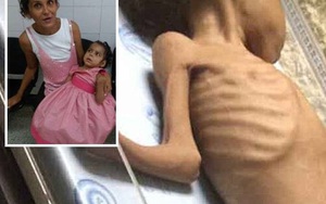 Thế hệ tương lai của Venezuela đang chết dần chết mòn vì đói ăn