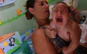 Virus Zika chính là thủ phạm gây teo não
