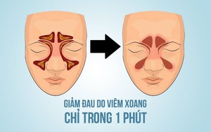 Bác sĩ Mỹ hướng dẫn cách giảm đau do viêm xoang chỉ trong 1 phút