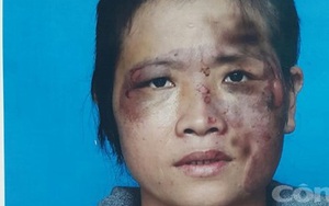 Vợ tố bị chồng tra tấn như thời trung cổ
