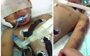Không chịu ăn đồ mẹ nuôi nấu, cô bé 3 tuổi bị đánh tới chết