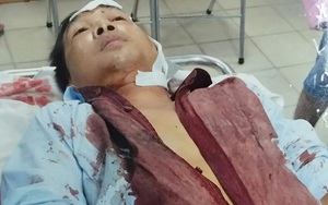 Một nhà dân ở Sài Gòn bị nhóm côn đồ hành hung dã man