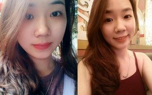 Gương mặt dễ thương của nữ sinh bị tạt axit khiến dân mạng xót xa