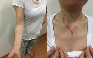 Hà Nội: Thấy người khác nhổ nước bọt ở thang máy, người phụ nữ nhắc thì bị đánh tới tấp