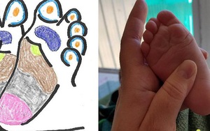 Xoa dịu 6 kiểu "khó ở" của con nhờ biết cách massage đôi chân