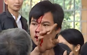 Đánh nhau chảy máu đầu trong cuộc họp đấu giá cây sưa 50 tỷ ở Bắc Ninh: Nguyên do vì đâu?