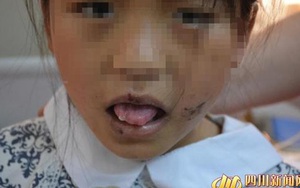Bé gái 10 tuổi bị mẹ lấy kìm cắt lưỡi, lấy kéo cắt tai như thời Trung cổ đúng ngày Tết thiếu nhi