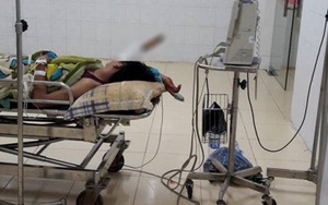 Mâu thuẫn khi ăn cơm, cầm dao đâm vào đầu đồng nghiệp