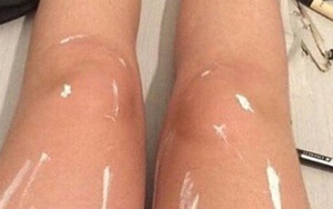 Đôi chân gây tranh cãi nhất thế giới: Được bôi dầu bóng, bọc nilon hay dính màu trắng?