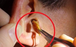 Phát hiện chấn động về sự khủng khiếp của những cặp tai nghe!