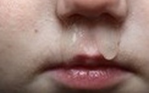 Mẹo nhỏ cực hay chấm dứt ngay sổ mũi