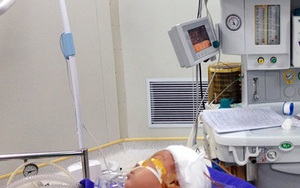 Bé 35 ngày tuổi bị dao quắm xuyên trán
