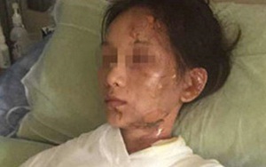 Nhân viên đổ nước lẩu sôi lên đầu khách hàng đòi gặp quản lý, cửa hàng phải bồi thường 800 triệu