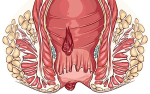 Những thực phẩm phòng căn bệnh mà cứ 10 người Việt thì có 5 người mắc phải