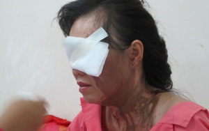 Một phụ nữ bị tạt axit tại trung tâm TP HCM