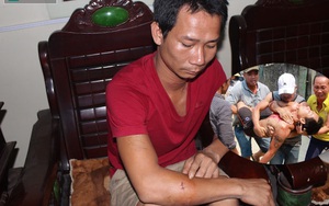 Cứu con tin khỏi kẻ trốn nã: "Tôi không dám cọ quậy vì sợ đứt cổ"