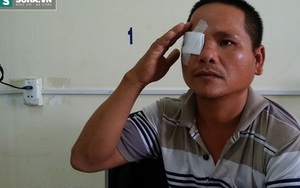 "Con bạc" tố bị công an bắn nổ mắt khi leo lên mái nhà trốn
