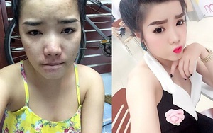 Sau 4 năm 'đấu tranh', cô gái quyết định lộ mặt mộc vì không muốn lừa dối bạn trai