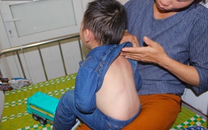 Nghệ An: Đàn ong rừng lao vào lớp tấn công cô giáo và 17 trẻ