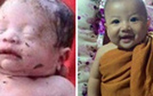 Sự hồi phục kỳ diệu của cậu bé người Thái Lan từng bị đâm 14 lần và chôn sống