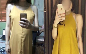 Có ý tốt mua váy online ủng hộ bạn, cô gái vẫn nhận "quả đắng" là chiếc váy xấu "không tả nổi"