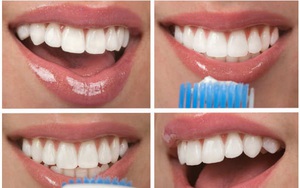 Khỏi cần đi nha sĩ, chỉ tốn vài nghìn đồng là bạn có thể lấy sạch cao răng ngay tại nhà