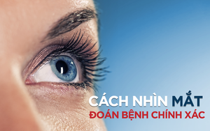 Cảnh báo: Người có dấu hiệu này ở mắt có thể sắp đột quỵ