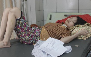 Cô gái "bà lão" lở loét toàn thân, răng rụng vì bệnh lạ